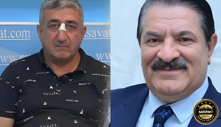 Ağadadaş Ağayevin balta atdığı mühafizəçi həbs edilib - ÖZƏL